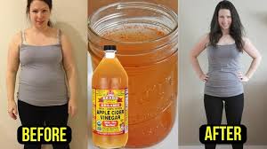 Maybe you would like to learn more about one of these? How To Use Apple Cider Vinegar For Belly Fat Ostomy Lifestyle