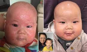 Or apply any aloe vera jelly. Mother Reveals Baby S Eczema Was Cured By A 7 99 Miracle Cream Daily Mail Online