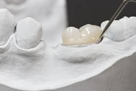 After all, your crown was meant to improve your oral health, not create any discomfort for you. How Do I Care For A Temporary Tooth Crown Warr Dental