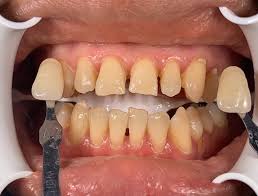 Check spelling or type a new query. Miss Fitrah88670741 Twitter