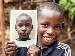 Operation Smile, Inc.