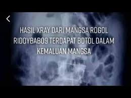 Check out botol on ebay. Download Viral Di Tiktok Kasus Botol Dimasukin Kemaluan Ridoy Babo Bangladesh Mp4 Mp3 3gp Naijagreenmovies Fzmovies Netnaija