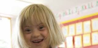 Down syndrome