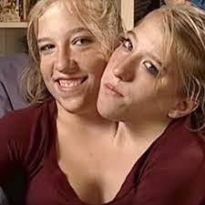 The world became obsessed with conjoined twins abigail abby and brittany hensel after they appeared on an episode of the oprah winfrey show in 1996. Inside The Life Of Conjoined Twins Abby And Brittany Hensel