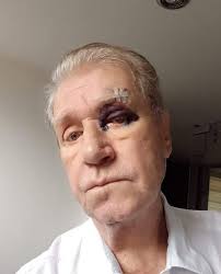 Julio Cesar Luna, una gloria de la TV colombiana que hoy vive el peor drama  de su vida