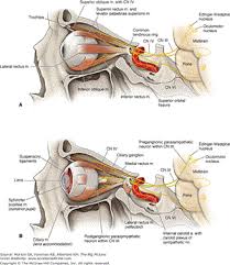 Image result for Pupillary Paralysis