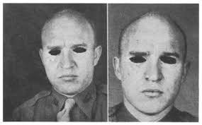 USE OF TANTALUM FOR FACIAL AND CRANIAL DEFECTS