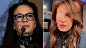 Yolanda Andrade reaparece sin el parche en el ojo y envía mensaje sobre su  estado de salud | Univision Famosos | Univision