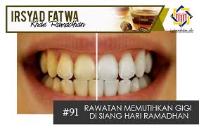Bersugi itu sunat, tapi kenapa ketika berpuasa perkara sunat seperti itu tidak boleh kita buat. Pejabat Mufti Wilayah Persekutuan Irsyad Al Fatwa Khas Ramadhan Siri Ke 92 Rawatan Memutihkan Gigi Di Siang Hari Ramadhan