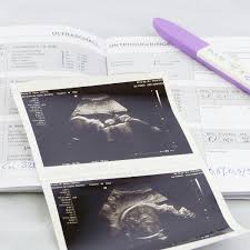 Dein mutterpass begleitet dich durch deine schwangerschaft. Der Mutterpass Einfach Erklart Chlamydia Hbs Titer Nichtnurmama De