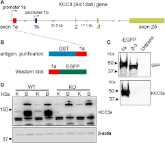 KCC3a, a Strong Candidate Pathway for K+ Loss in Alkalemia
