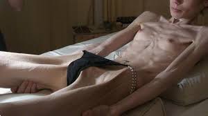 Janine Skinnyfans Anorexic