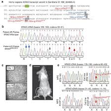 Exudative pleural effusions meet at least one of the following criteria, whereas transudative pleural effusions meet none. Mutant Kras Promotes Malignant Pleural Effusion Formation Nature Communications