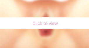 Cosmetic surgery's goal is to improve your appearance. Toronto Labiaplasty Labia Reduction Trim All Female Staff