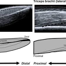 30,980 likes · 39 talking about this. Pdf In Vivo Measurements Of Biceps Brachii And Triceps Brachii Fascicle Lengths Using Extended Field Of View Ultrasound