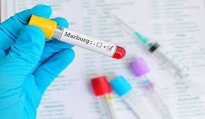 Marburg, which is in the same family as the virus. Izjct5a43uetcm