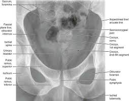 Normal Anatomy Radiology Key Radiology Imaging Medical Radiography Radiology