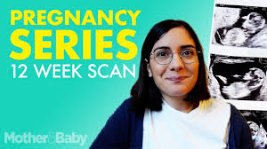 Find out more about value combined how test for down's syndrome. 12 Weeks Pregnant Ultrasound What To Expect Mother Baby