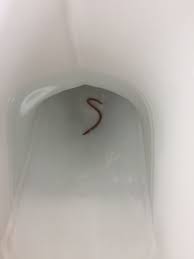 Tiny black worms in the toilet may indicate that you may have some type of infestation of larvae somewhere in your sewer system. There S A Worm In My Toilet Mumsnet