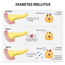 Diabetes In Dogs Causes Symptoms Treatment Diet Management