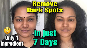 Years ago, a scratch would heal and disappear within a few weeks. Remove Dark Spots In Just 7 Days 100 Natural Remove Pigmentation In A Week Malayalam 90 Youtube