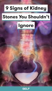 Kidney Stones Have No Easy Remedy Everything From Your Hydration Levels And Diet Can Cause Differe Signs Of Kidney Stones Kidney Stones Kidney Stones Symptoms