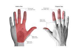 The median nerve passes through the carpal tunnel and gives rise to the palmar digital nerves supplying sensation to the lateral digits and motor innervation of the lateral two lumbricals. Median Nerve Neurologyneeds Com