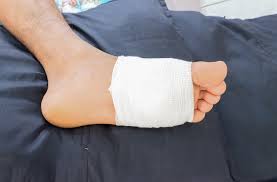 Image result for Wound