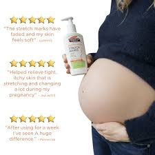 This moisturizer keeps skin supple and can prevent or minimize the formation of stretch marks. Palmer S Cocoa Butter Formula Massage Lotion For Stretch Marks