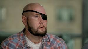 Organ Transplant news