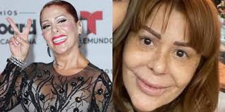 Sus fotos más recientes evidencian el gran cambio que ha tenido por las cirugías plásticas. Este Es El Nuevo Rostro De Alejandra Guzman Tras Someterse A Muchas Cirugias Plasticas Ociolatino Com