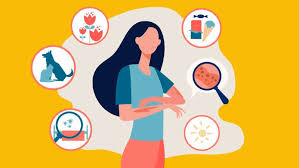 Image result for Allergic Rhinitis