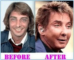 15 Celebrities With The Most Plastic Surgery Sieber Plastic Surgery