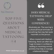What are the five most asked questions about medical tattooing?