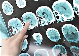 Lie detector tests in darlington: Three Lie Detection Methods