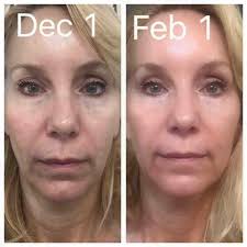 Consistent face washing with right products