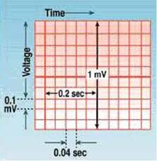 Kertas ekg 1 kotak kecil horizontal = 0.04 detik 1 kotak kecil vertikal = 0.1 mv 1 kotak besar terdiri atas • 5 kotak kecil horizontal • 5 kotak kecil vertikal hal ini penting untuk anda ingat karena dari sini kita bisa mengetahui apakah ada kelainan atau tidak pada sebuah hasil ekg. Belajar Ekg Yukz Ms Casual