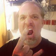 Jesse James Chops Pinky Finger Tip While Working At Shop [Graphic Photos]