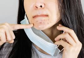 Everyone has it, yet many women struggle with the hair on their faces anyways and are looking for solutions to remove or reduce it or stop the growth altogether. The Struggle With Maskne Is Very Real Health Essentials From Cleveland Clinic Health Essentials From Cleveland Clinic