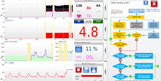 New Features Lidco Hemodynamic Monitoring For The Entire