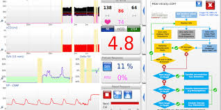 new features lidco hemodynamic monitoring for the entire