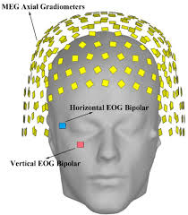 An Automatic Identification Method for the Blink Artifacts in the  Magnetoencephalography with Machine Learning