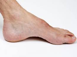 Elle se transmet par les autosomes , soit selon le mode dominant , soit selon le mode récessif. Maladie De Charcot Marie Tooth Un Traitement En Developpement Le Quotidien Du Pharmacien Fr