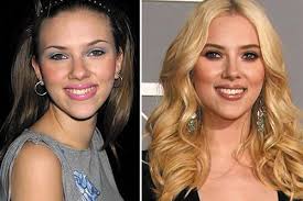 Scarlett Johansson Plastic Surgery Has She Had A Nose Job Hair Implants Scarlett Johansson Nose Job