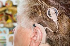 Is the Kanso 2 cochlear implant suitable for a 3-year-old child?