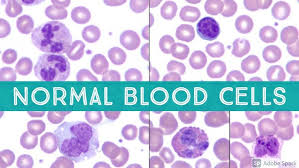 Image result for Peripheral Smear