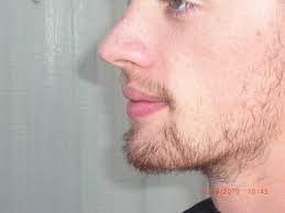 Unfortunately, like many other aspects of transition, there's a lot of misinformation and. No Shave November Separates Boys From Men The Mycenaean