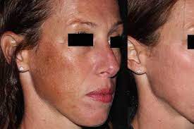 I had an amazing experience here last week! Laser Aesthetic Center Beauty Health Hinsdale Il Weddingwire