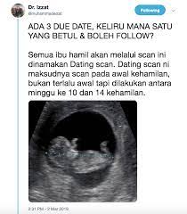 B3 b4 b5 b6 l7 l8 l9 l 10 l 11 l 12. Ada 3 Due Date Bersalin Tapi Mana Satu Yang Betul Ini Penerangan Dari Pakar