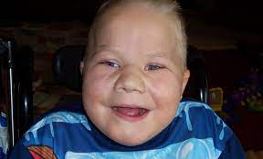 This includes severe intellectual disability, as well as health problems involving nearly every organ system in the body. Trisomy 13 A Handbook For Families Soft Support Organization For Trisomy Parenting A Child